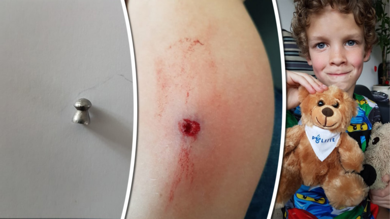 Zevenjarige Djulian beschoten tijdens het voetballen